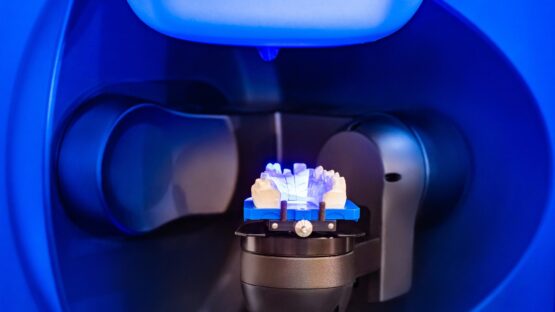 lower arch being digitally designed digital design lower arch for dental implants