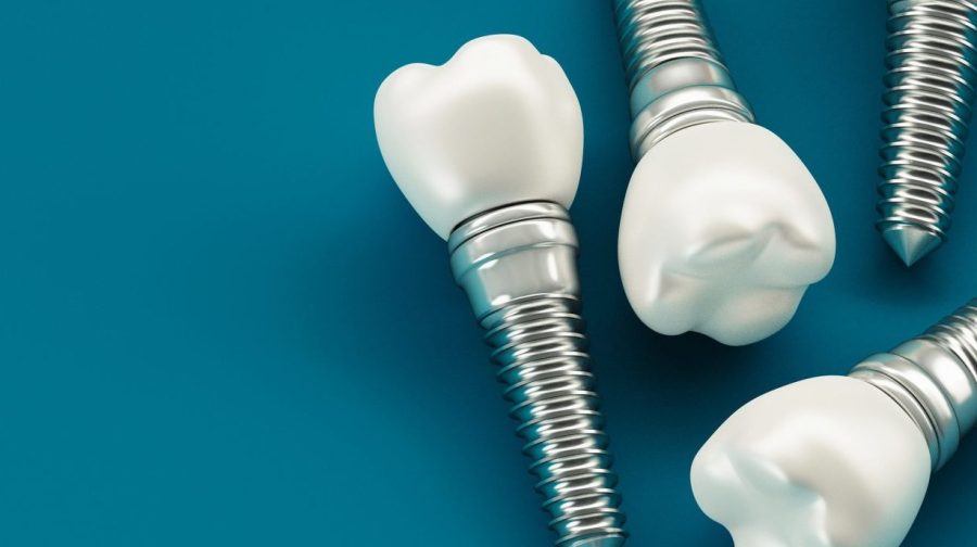 mini dental implants, mini implants